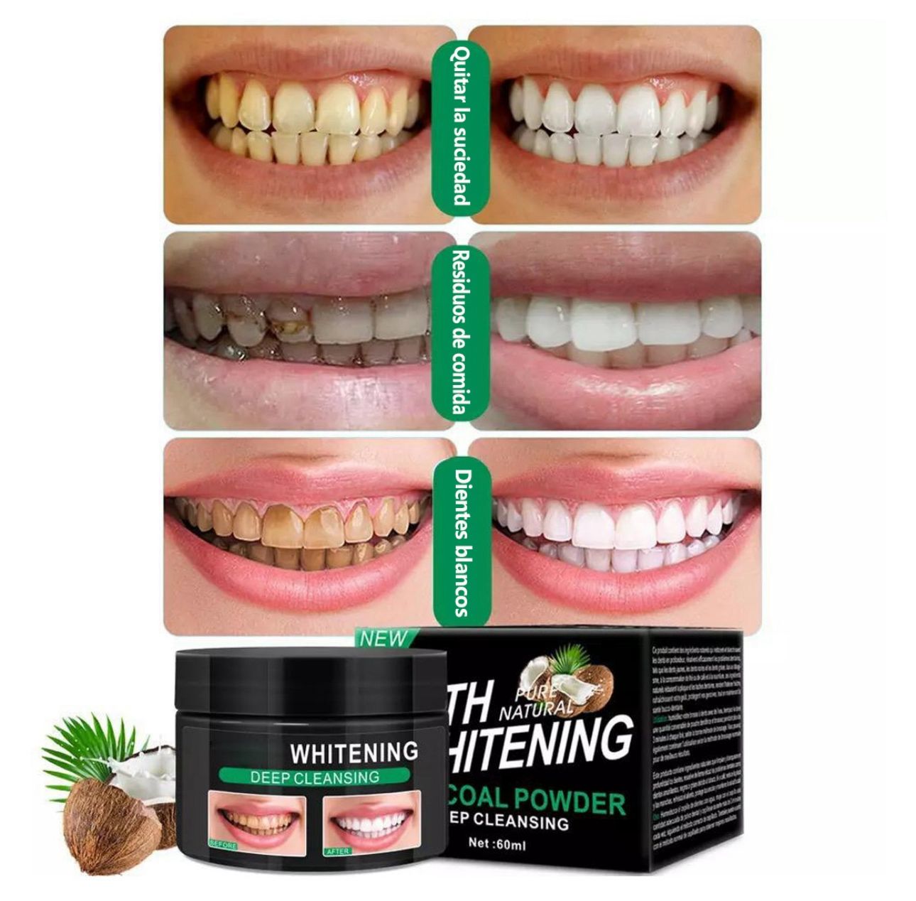 Combo Sonrisa Premium – Carbón Activado + Irrigador Bucal